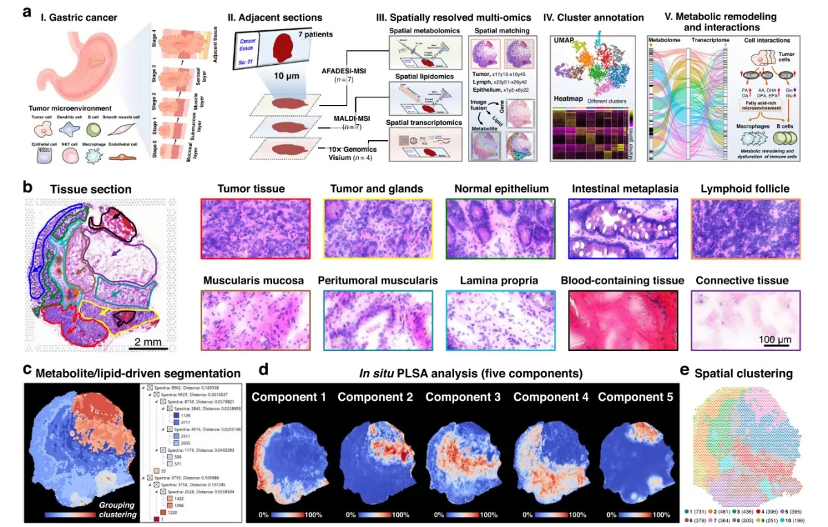  Spatially resolved multi-omics reveals intratumor heterogeneity of gastric cancer (Sun et al., 2023)